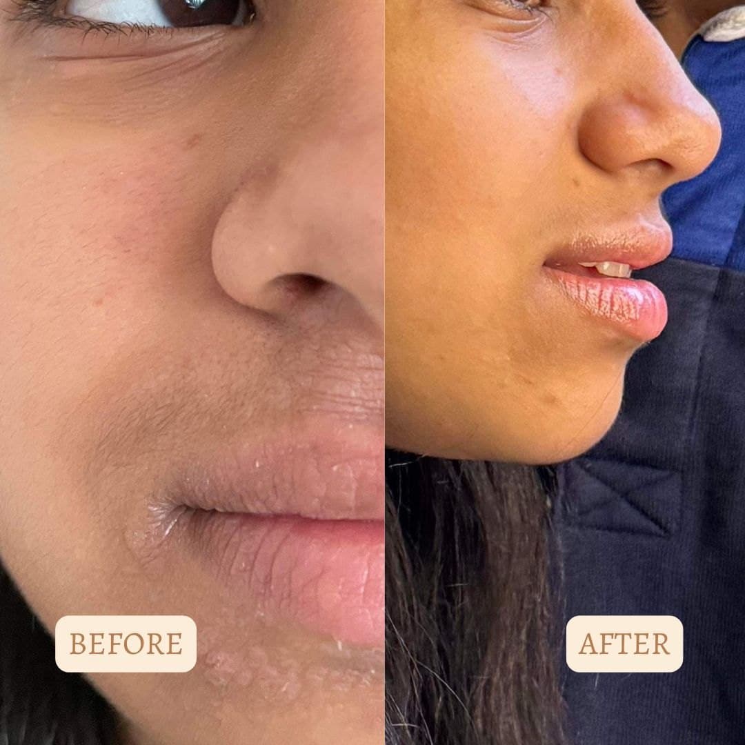 Customer before and after result 1