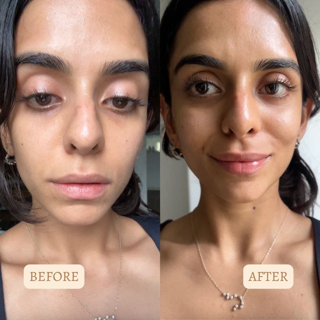 Customer before and after result 5