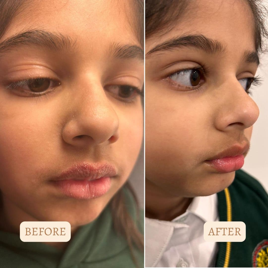 Customer before and after results with Inherited Skincare