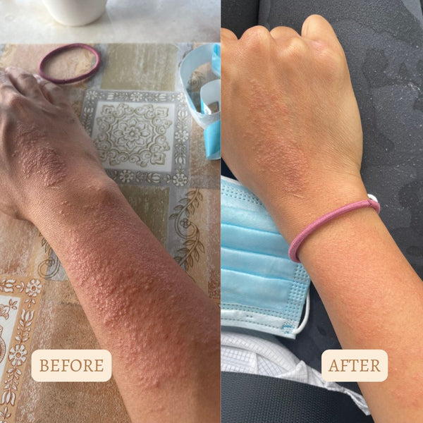 organic body moisturiser for dry and chapped skin